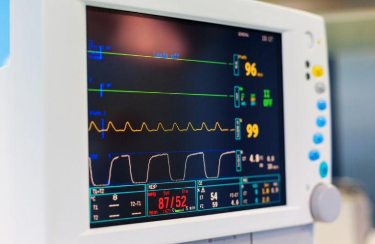 Ekg Cihazı
